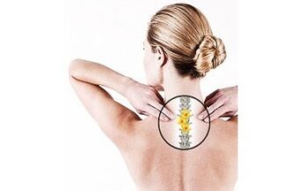 ostéochondrose cervicale chez une femme