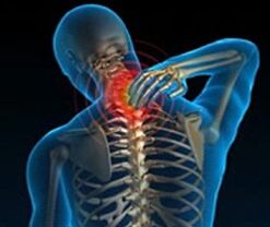 ostéochondrose de la colonne cervicale