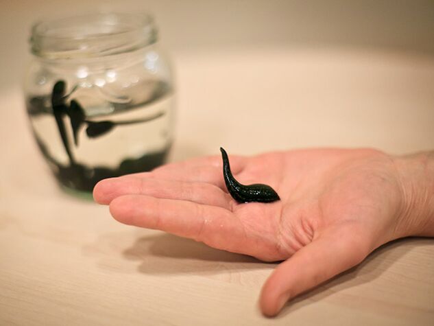 Application au traitement de l'arthrose de l'articulation du genou.